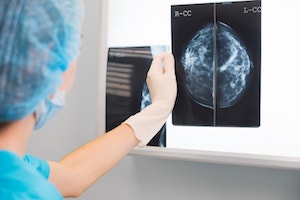 Diagnose Breast Cancer